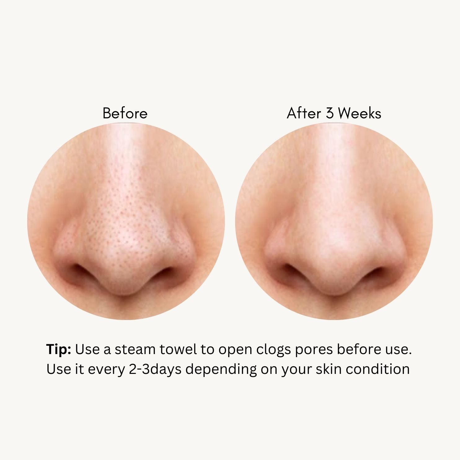 Tako Pore Blackhead Scrub Stick