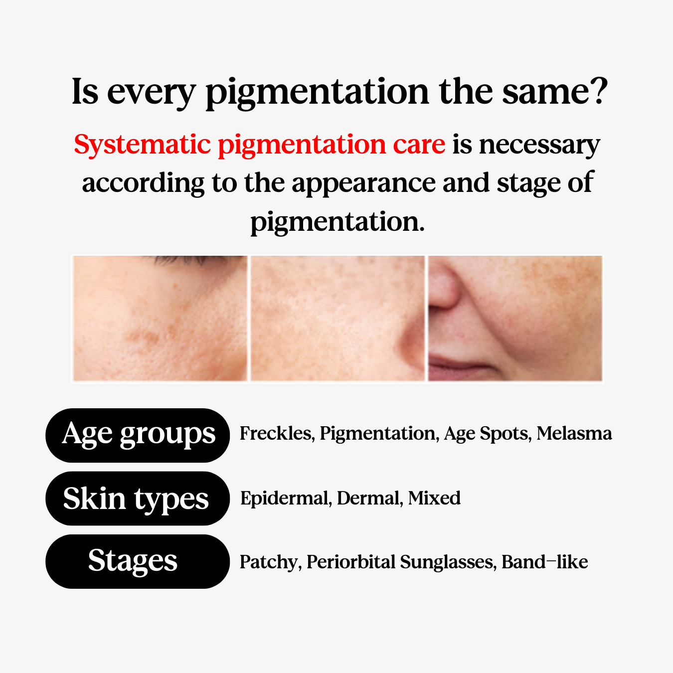 Gimiya Whitening Cream (Renewed Packaging)