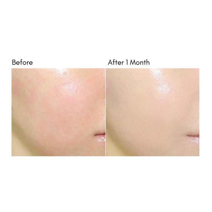 Intense Care Gold 24k Snail Cream