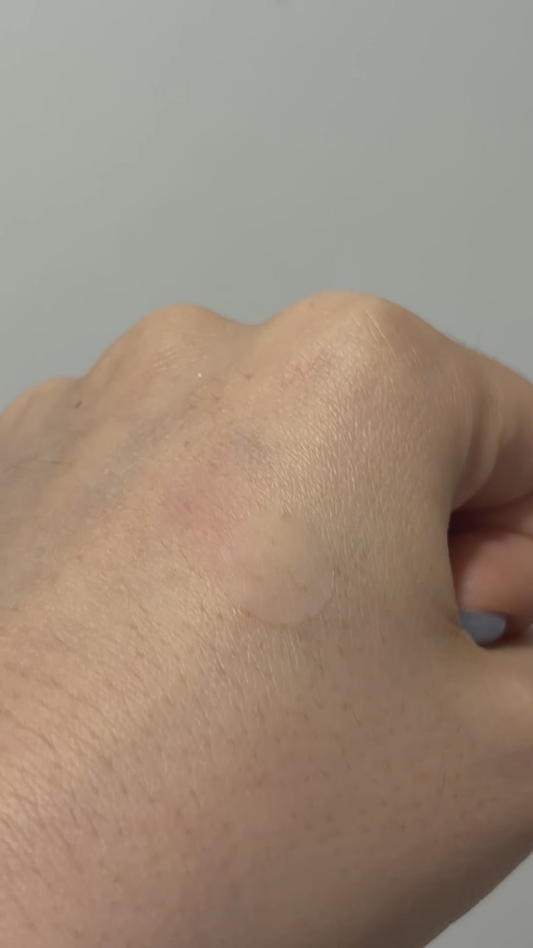 Adios Imperfecciones – Pimple Patch (24pcs)